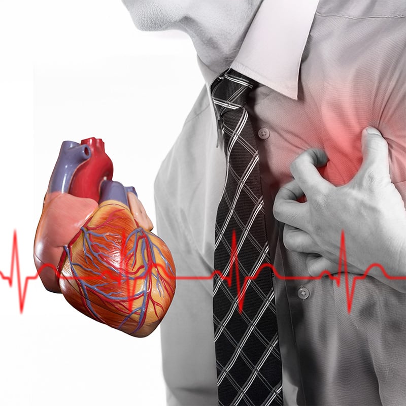 muz sa chyta za srdce, obrazok srdca a ekg